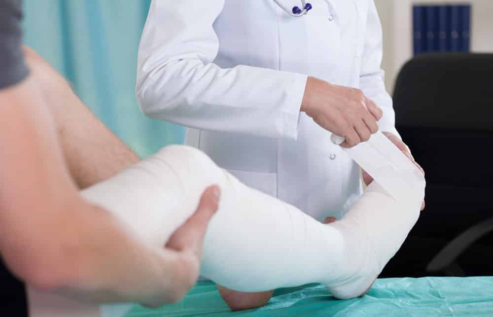 Doctor putting a cast on a patient's foot